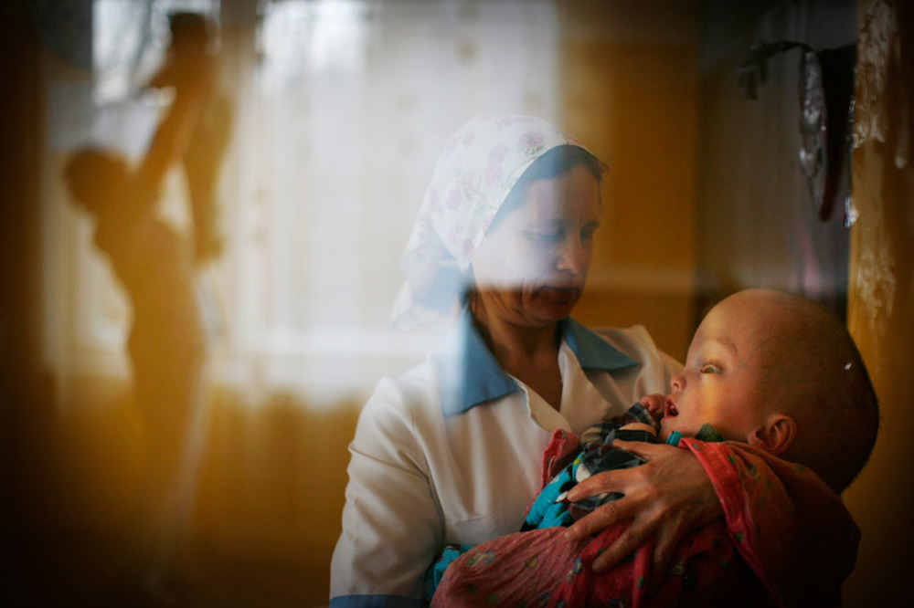 На фото мальчик, родившийся после испытаний на Семипалатинском полигоне. Фото Эда Оу, как иллюстрация чудовищного воздействия радиации на будущие поколения.
